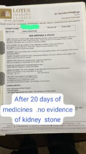 Recurrent Kidney Stone (3–4 mm) Treated Successfully in 20 Days with Ayurvedic Medicine
