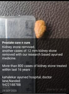 Kidney Stone Case