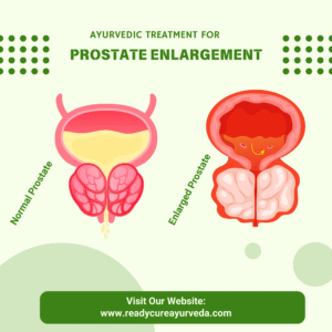 Ayurvedic Treatment for Prostate Enlargement in Pune | Mumbai