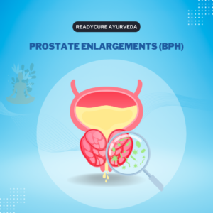 प्रोस्टेट ग्रंथी वाढणे आणि लघवीचा त्रास: नॉन-सर्जिकल उपचार