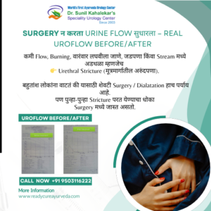 बिना सर्जरी Urine Flow में सुधार – Uroflowmetry Test Before & After | Research-Based Uttarbasti Therapy